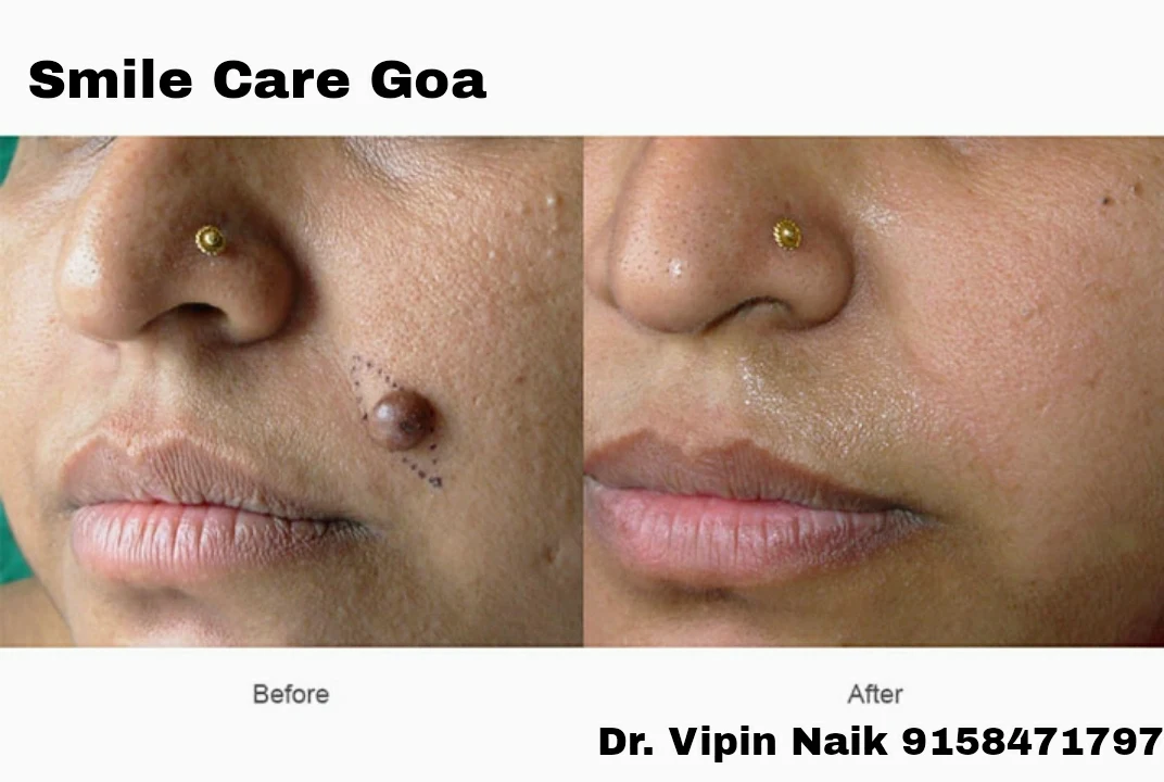 Smile Care Goa Gallery